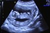 Baby 12 weken 1.jpg