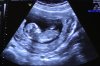 Baby 12 weken 2.jpg