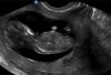 baby2.jpg