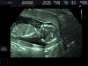 chipmunk 16wk boy.jpg