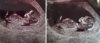 baby2.jpg
