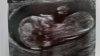 echo baby 2.jpg