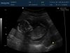 Baby Brouwer_0001.jpg