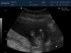 Baby Brouwer 1_0002.jpg