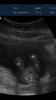 Screenshot_2015-03-10-13-01-30.jpg