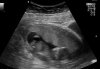 baby3.jpg