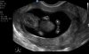 baby6.jpg