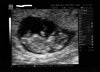 2015-03-16 Echo 1 zp.jpg