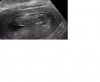 baby.jpg