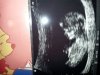 echo 11 weken baby 2.jpg