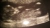 20150417_214243.jpg