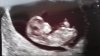Baby 1.jpg