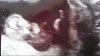 Baby 2.jpg