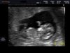 BABY_0006_aangepast.jpg