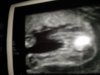 20150426_221913.jpg