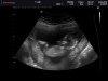 BABY_0006.jpg