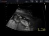 BABY_0012.jpg