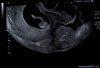 UltrasoundPic18303.jpg