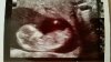 baby.jpg