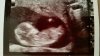 baby.jpg