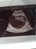 Baby 9+2.jpg