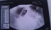 11338-albums9415-picture54758.jpg