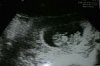 beeb 8 week.jpg