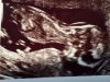 Foto echo 1 op 1 juni 2015 13 wk en 3 dagen.jpg
