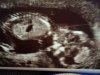 Foto 2 echo 1 juni 2015 13 wk 3 dagen.jpg