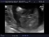 15w4d (9).jpg