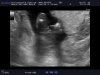 15w4d (3).jpg