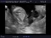 15w4d (7).jpg