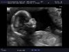 15w4d (4).jpg