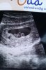 echo 7,5wk.jpg