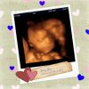 BABYVIEW_36-1.jpg