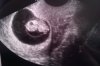 24-08-12  8,5wk.jpg