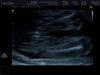 20 WKN ECHO_0002.jpg