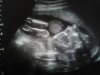 Baby de Reus met 20-weken.jpg