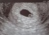 Echo 31-08-2012.jpg