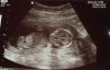 14weeks.jpg