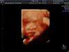 baby Koopmman_12.jpg