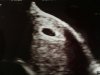 echo baby 6weken.jpg