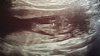 IMG-20150921-WA0000.jpg
