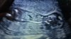 20150928_165925.jpg