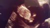 20150929_192315.jpg