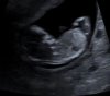 baby nr 2.jpg
