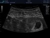 J150214_249590_Echo.jpg