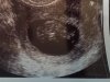 echo baby 9.3 weken (2).jpg
