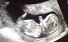 baby 12w 2d...jpg