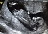 baby 12w 2d.jpg